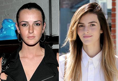 Ojoj! Je imela mlajša sestra Lindsay Lohan plastično operacijo?