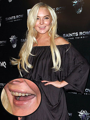Ojoj! Lindsay Lohan šokirala z rumeni zobmi in nohti