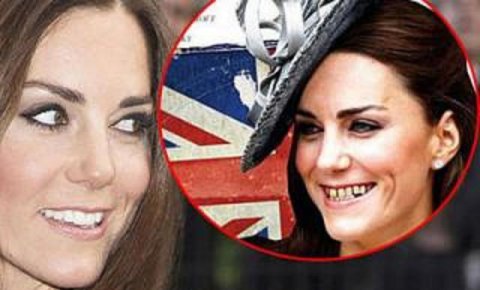 ŠKANDAL Fotografija iznakažene Kate Middleton