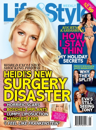 Operacijska katastrofa: Heidi Montag pokazala grozne brazgotine lepotnih posegov