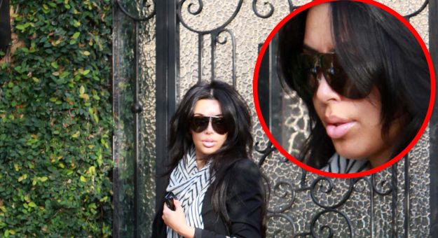 FOTO Napumpane ustnice Kim Kardashian izgledajo kot, da bi imela hudo alergijo