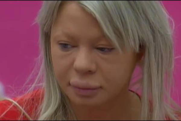 FOTO Big brother slavnih: Grozno zabuhla Urša Čepin je zjutraj neprepoznavna