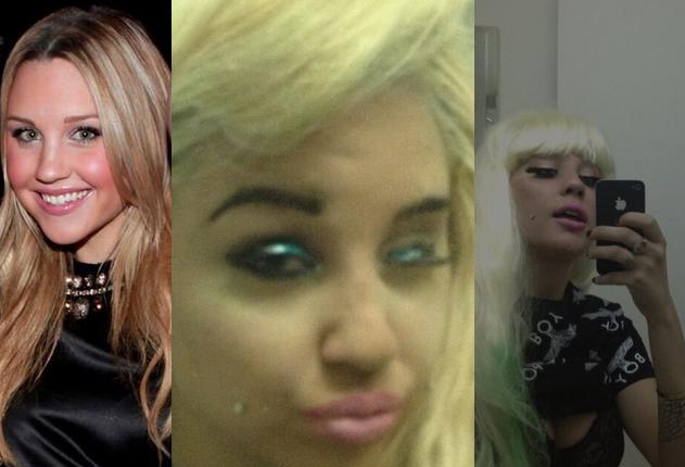 Amanda Bynes: Po lepotnih operacijah je neprepoznavna