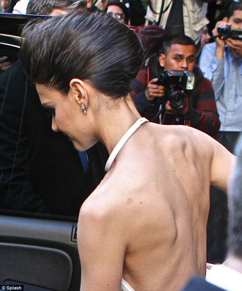 Ojoj! Katie Holmes: Na ogled postavila koščen hrbet