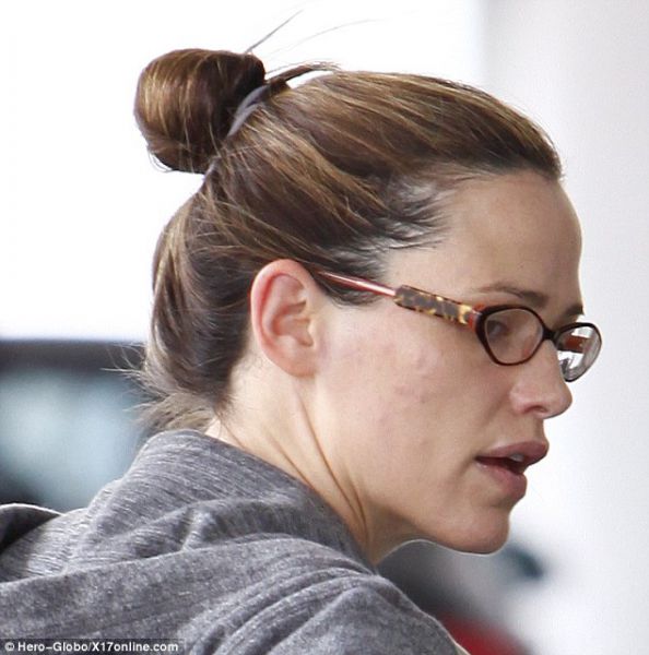 Ops! Tudi Jennifer Garner ima mozolje!