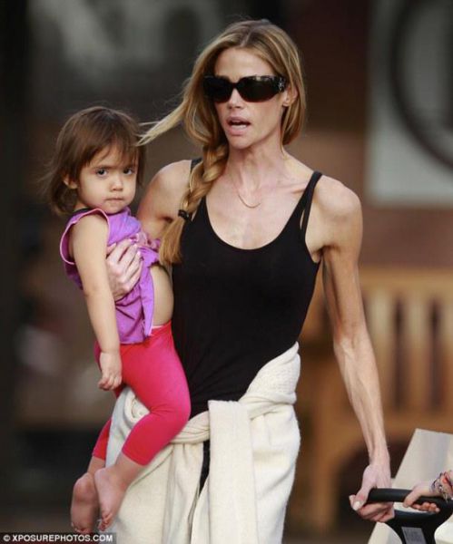 OJOJ! Od Denise Richards ostale le še kosti in koža