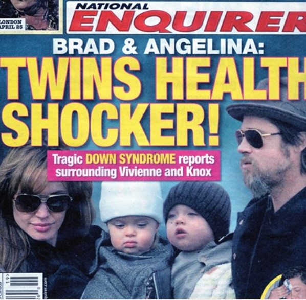 Ali dvojčka Jolie-Pitt res trpita za Downovim sindromom?!