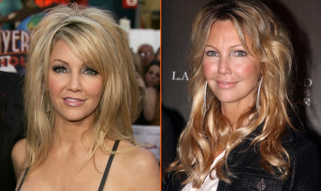 OJOJ! Izumetničena Heather Locklear močno pretirava z botoksom