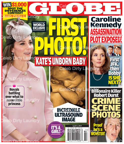 Foto! Kate Middleton: Prva fotografija nerojenega otroka?