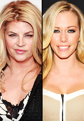 Propadla igralka Kirstie Alley v šovu Plešemo z zvezdami