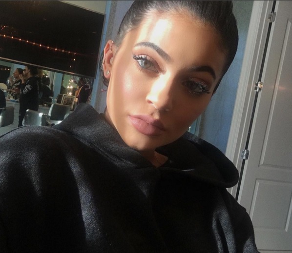Kylie Jenner pojasnila svojo veliko brazgotino