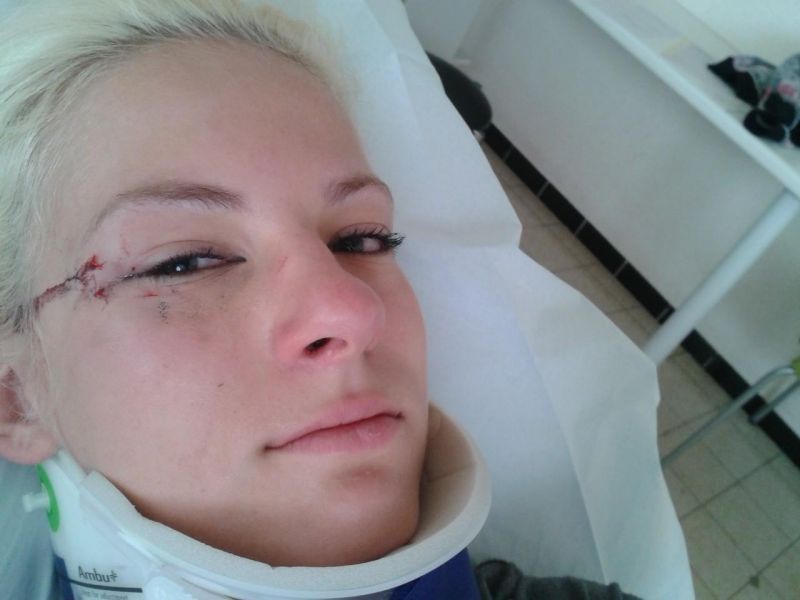 OJOJ! Lara iz šova Kmetija: Nov Začetek zaradi konja skoraj ob oko!