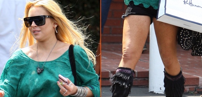FOTO Lindsay Lohan se je zredila in dobila podbradek