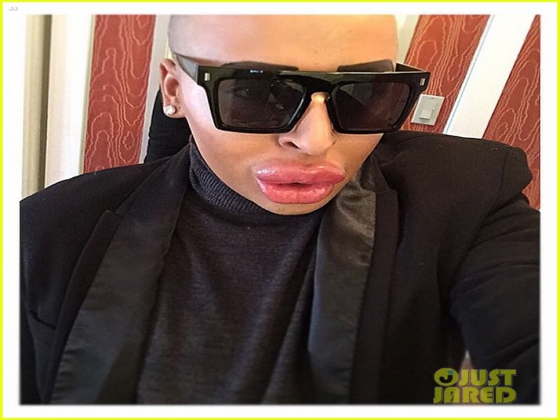 Ojoj! Poglejte, kaj Kim Kardashian povzroča s svojim videzom!