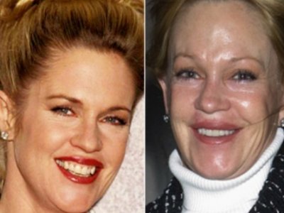 FOTO Melanie Griffith postarana in zgubana zaradi alkohola in drog