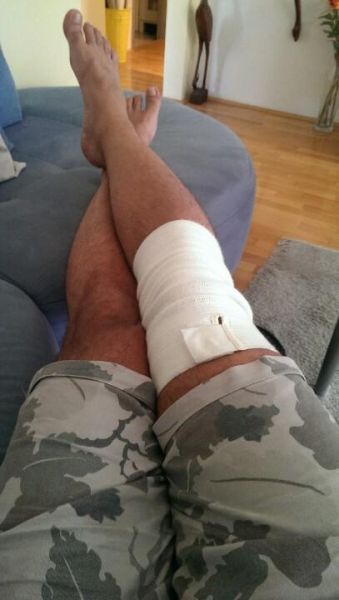 OJOJ! Kaj se mu je zgodilo?