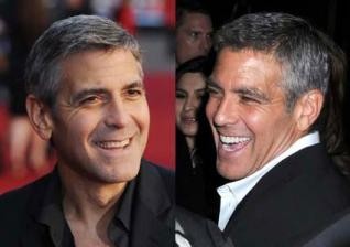 George Clooney si je polepšal nasmeh