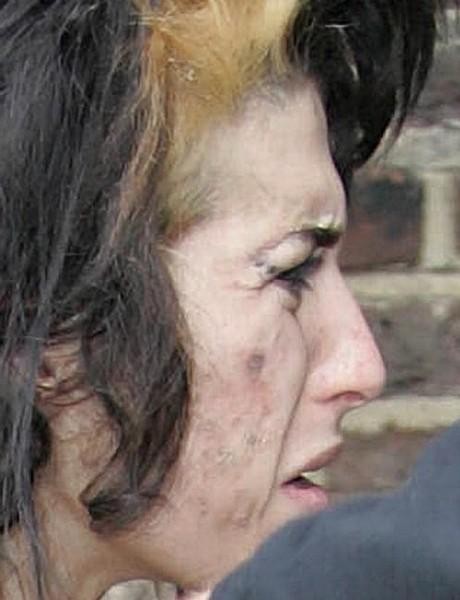 Razpadajoči obraz Amy Winehouse