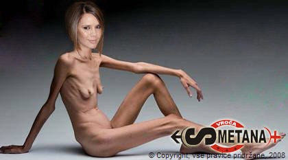 Fotomontaža: Anoreksična Victoria Beckham