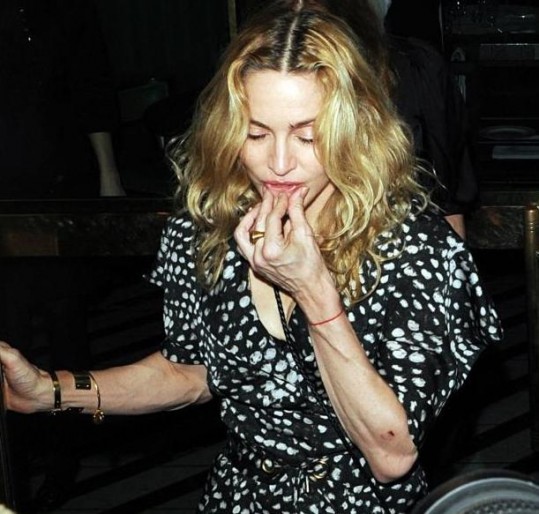 Madonna si pomaga s kisikom