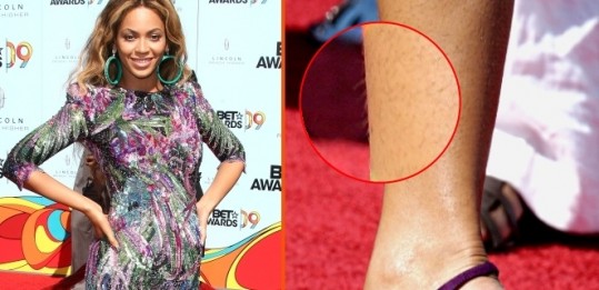 Je kosmata Beyonce odpustila tudi modnega stilista?