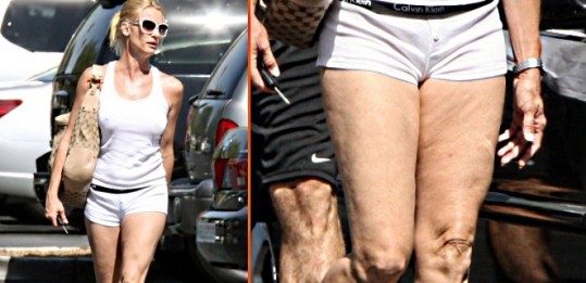 Nicollette Sheridan s celulitom in obilico mlahave kože