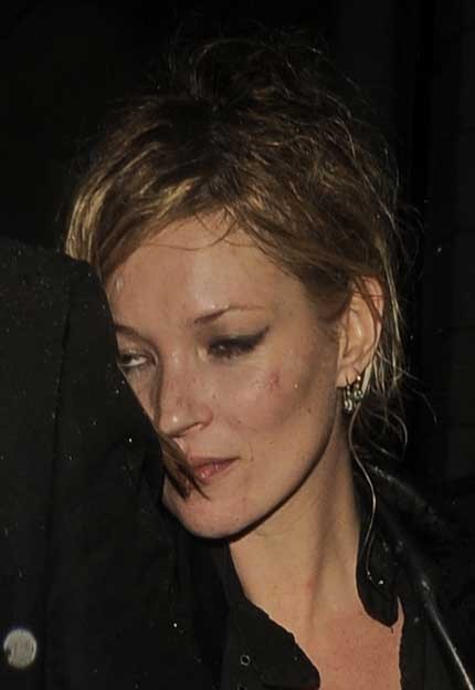 Zanemarjena Kate Moss