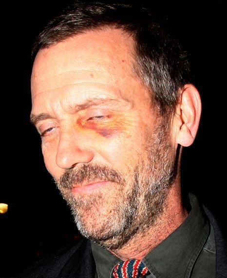 ŠOK Pretepeni Dr. House?