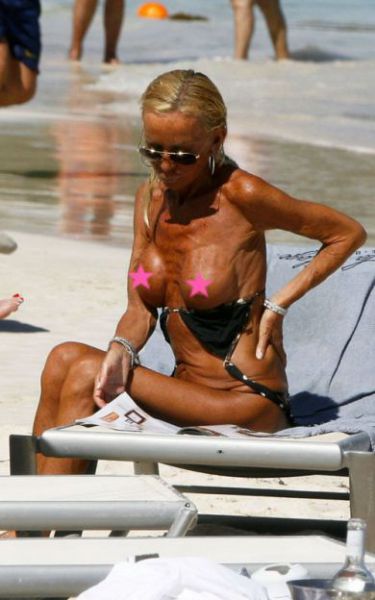 Ojoj!Zgubana in anoreksična Donatella Versace pokazala povešene joške