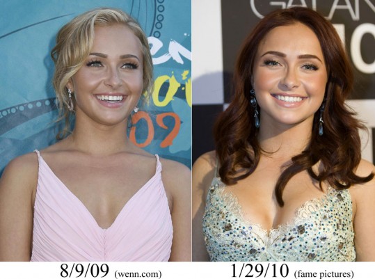 Hayden Panettiere: Si je povečala joške?