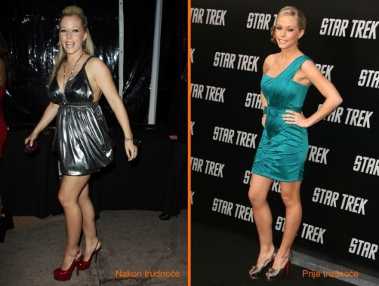 Kendra Wilkinson: Sovražim svoje prsi!