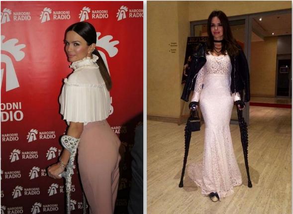 Kdor ima, lahko! Severina: Druga oblačila, drugačne berglje!