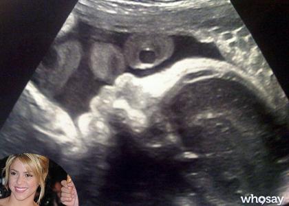 Foto: Shakira objavila prvo fotografijo svojega nerojenega sinčka