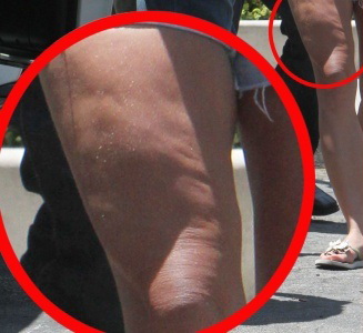 FOTO Britney Spears pokazala grozno celulitasta stegna