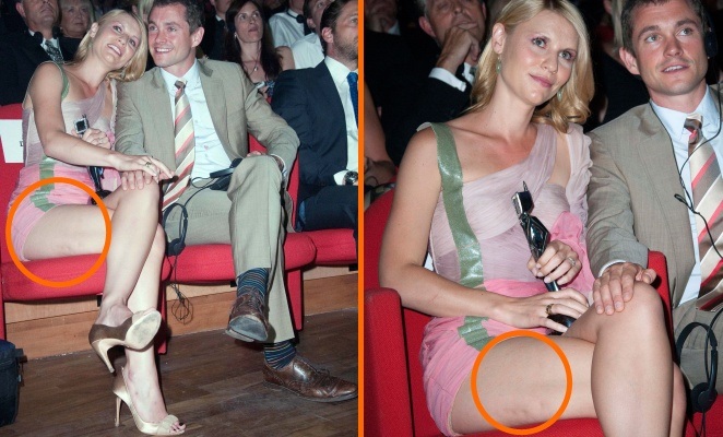 FOTO Hollywoodska igralka pokazala celulitasta stegna