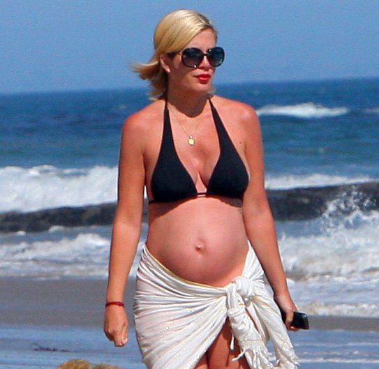 BIZARNO Si je noseča Tori Spelling privoščila čeljustne vsadke?!