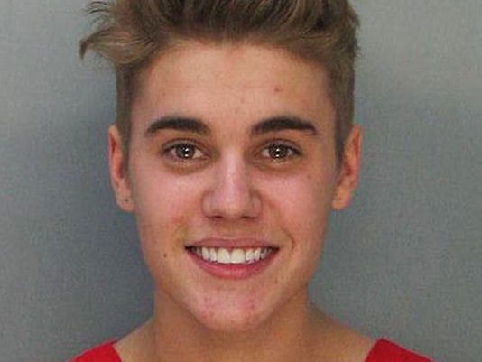 Justin Bieber: Ne bo več zastopnik za Proactiv!