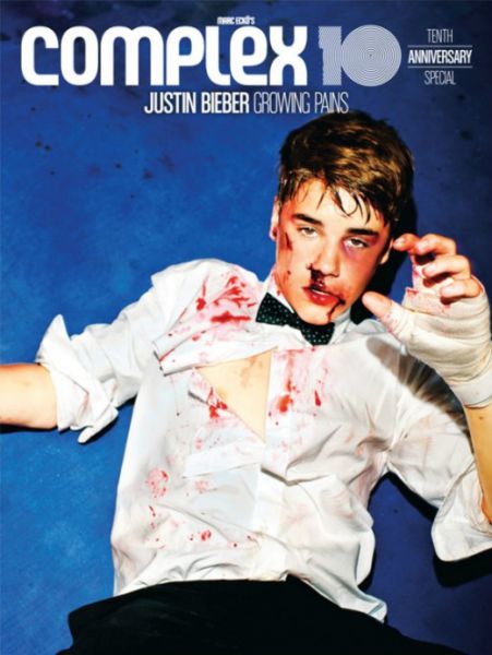Šok! Justin Bieber: Pretepen in krvav!