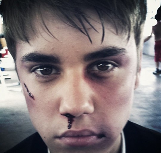 ŠOK: Justin Bieber: Pretepen!