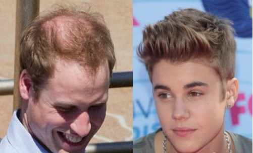 Justin Bieber daje nasvete za plešavost!