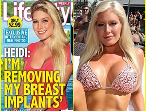 Heidi Montag: V kopalkah pokazala fantastično, a umetno telo!