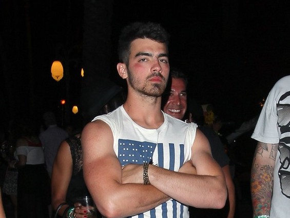 FOTO: Joe Jonas: Le kje je staknil modrico na obrazu?!