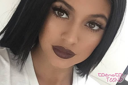 ŠKANDAL? Kylie hvali svojega plastičnega kirurga!