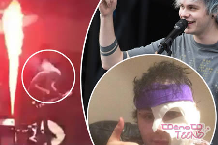 ŠOK! 5SOS: Michael se je ožgal na koncertu!