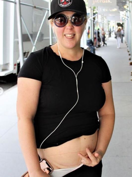 Amy Schumer