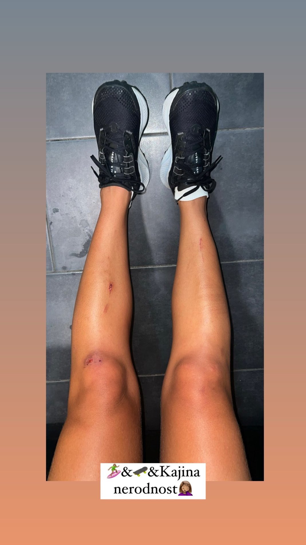 Kaja Casar in njene noge. Vir: Instagram