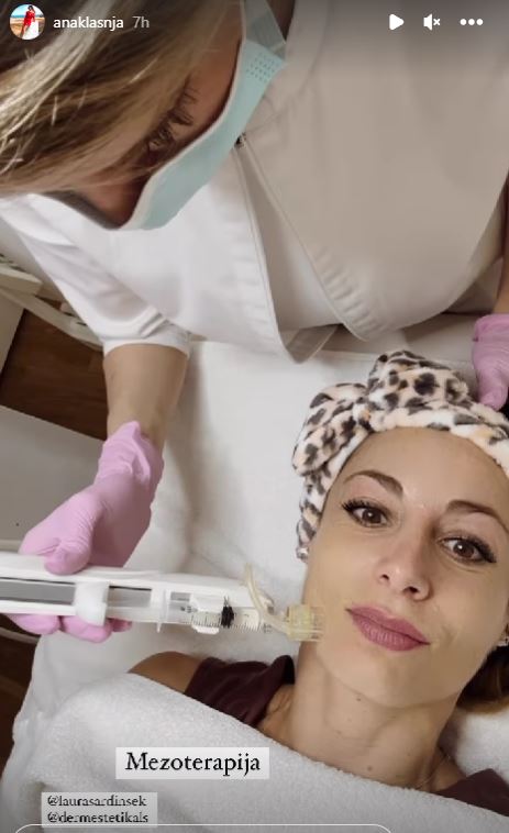 Ana Klašnja na mezoterapiji. Vir: Instagram