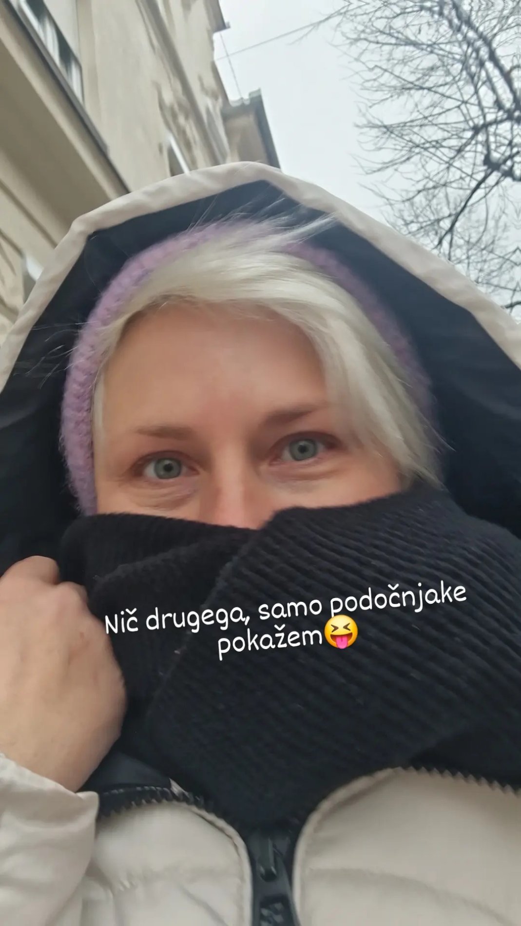Ana Praznik s podočnjaki. Vir: Instagram