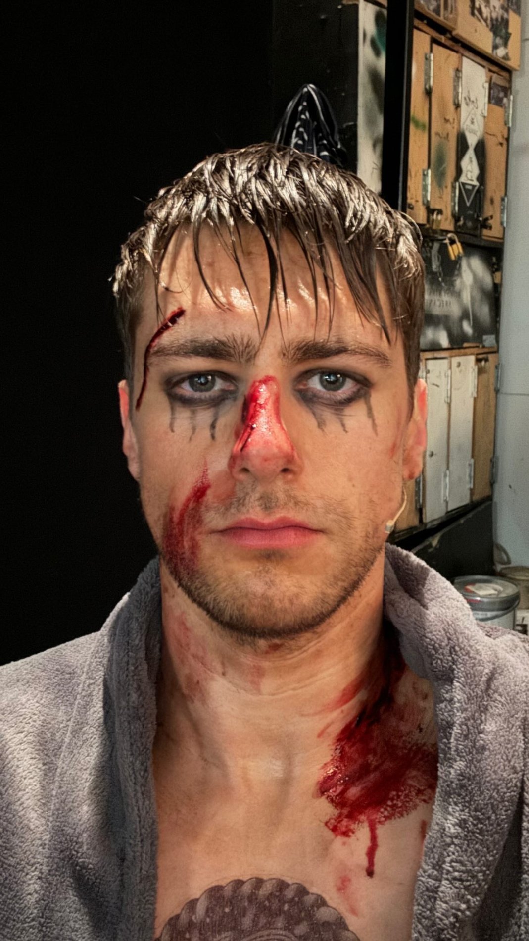 Matej Zemljič okrvavljen