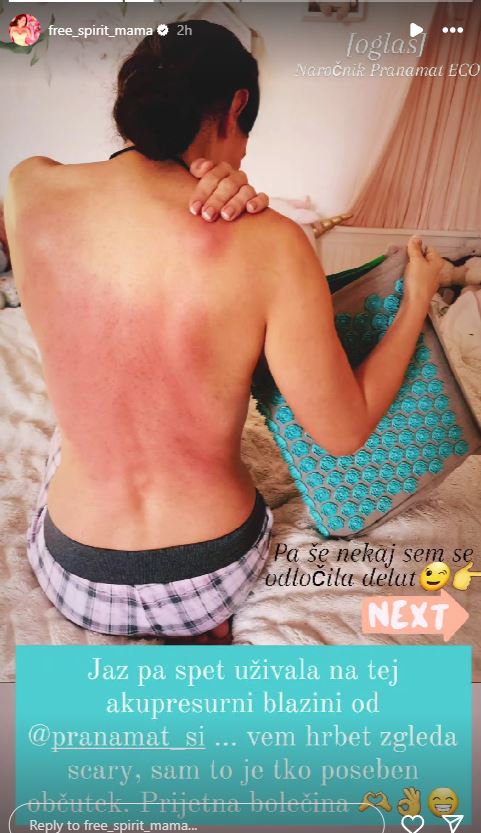 Hrbet Iris Mulej izgleda zelo boleče. Vir: Instagram